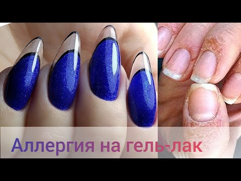 Видео: УЖАС😭 АЛЛЕРГИЯ НА ГЕЛЬ-ЛАК😱ЧТО ДЕЛАТЬ🤷КАК ИЗБЕЖАТЬ💅 ХРУСТАЛЬНЫЙ ФРЕНЧ💙МАНИКЮР/НАРАЩИВАНИЕ САМА СЕБЕ🤦
