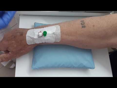 Видео: 013. Уход за внутривенным катетером.