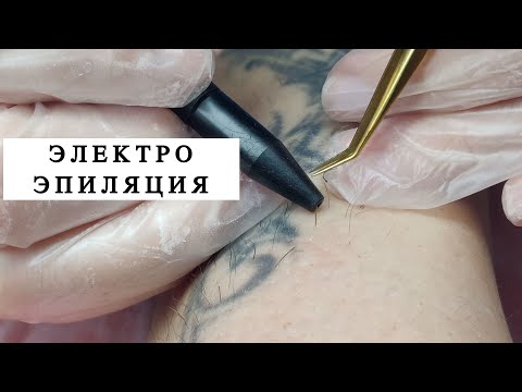 Видео: Электро-эпиляция: мой первый опыт! ЭТО БОЛЬНО! Перешла с лазерной эпиляции на электро и не жалею!