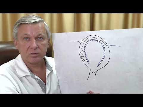 Видео: Отношения мужчины и женщины Психосоматика кисты, молочницы, эндометриоза. Психолог Азаров