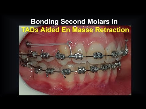 Видео: Склеивание 7-ок при использовании TAD