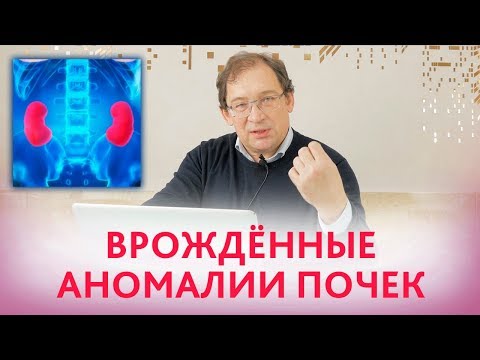 Видео: ГИДРОНЕФРОЗ и ПИЕЛОЭКТАЗИЯ - врождённые аномалии почек плода и новорожденного. Клинический случай.