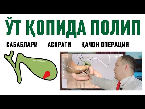 Видео: ЎТ ҚОПИДА ПОЛИП ХАҚИДА ДОКТОР ИСЧАНОВ БАФУРЖА МАЪЛУМОТ, САБАБ, БЕЛГИ, АСОРАТ, ДАВО ЧОРАЛАРИ
