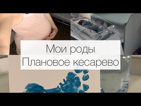 Видео: История моих родов | Плановое кесарево сечение | КС |