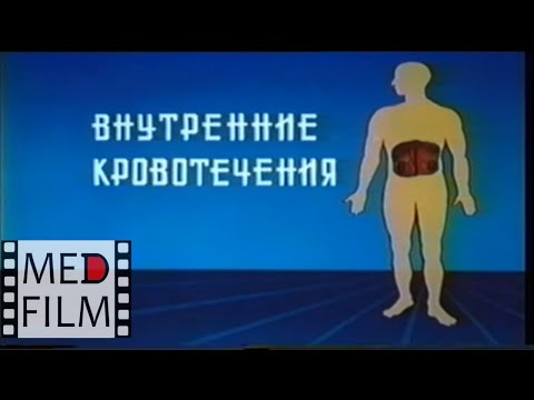 Видео: Внутренние кровотечения © Bleeding internal