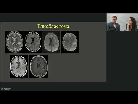 Видео: Вебинар МРО РОРР: “Синдром внутримозговой кисты: диф.диагноз на примере клинических случаев.”