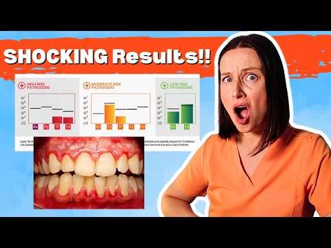 Видео: Что показал анализ ДНК моей слюны о моем организме!