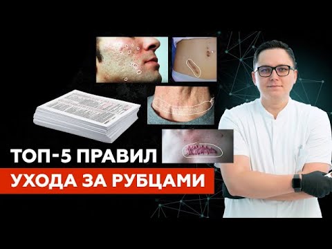 Видео: Как ухаживать за рубцами кожи?