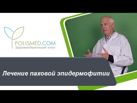 Видео: Лечение паховой эпидермофитии: противогрибковые средства, антимикотики. Народная медицина