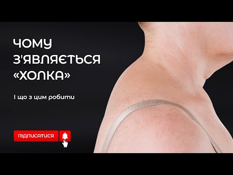 Видео: Почему появляется "холка" и что с этим делать?