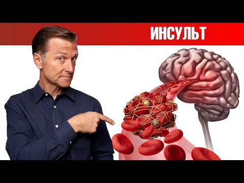 Видео: Как предсказать тихий инсульт?🤷‍♀️