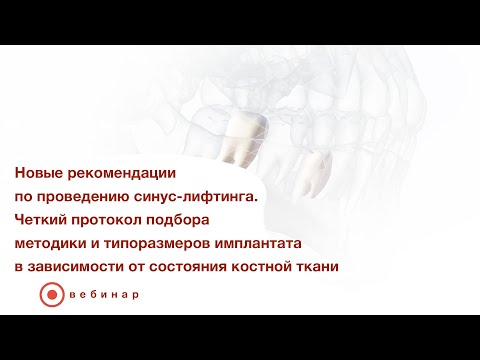 Видео: Новые рекомендации по проведению синус-лифтинга