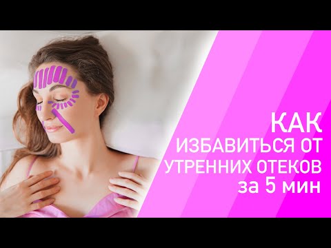 Видео: КАК ИЗБАВИТЬСЯ ОТ УТРЕННИХ ОТЕКОВ ЗА 5 МИН