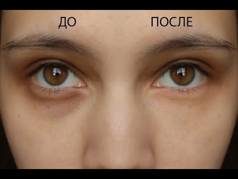Видео: Убираем синяки под глазами в Фотошоп