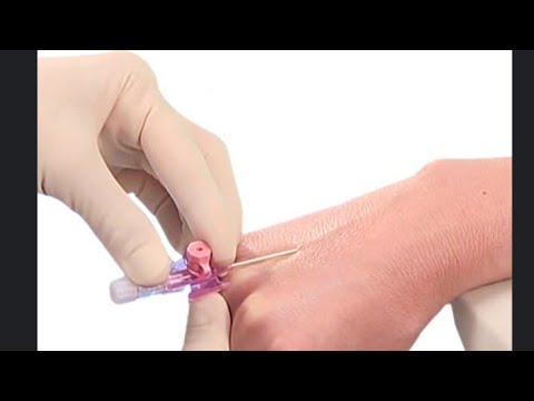 Видео: Периферический катетеризация / Венозды катетер