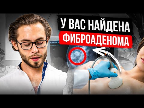 Видео: ЧТО ТАКОЕ ФИБРОАДЕНОМА l КАК ИЗБАВИТСЯ ОТ НЕЁ?