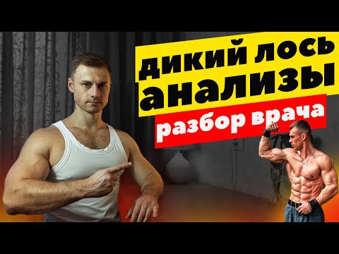Видео: Дикий Лось. Разбор анализов от врача.
