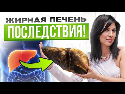 Видео: Как почистить печень от жира БЕЗ лекартв. Жировой гепатоз