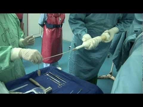 Видео: Д-р Николай Тивчев - Вертебропластика