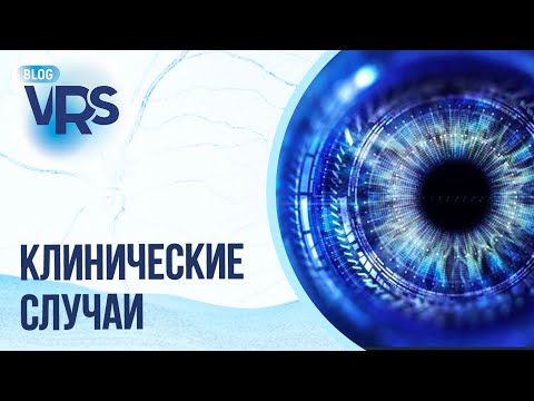 Видео: Запоминающиеся клинические случаи из практики