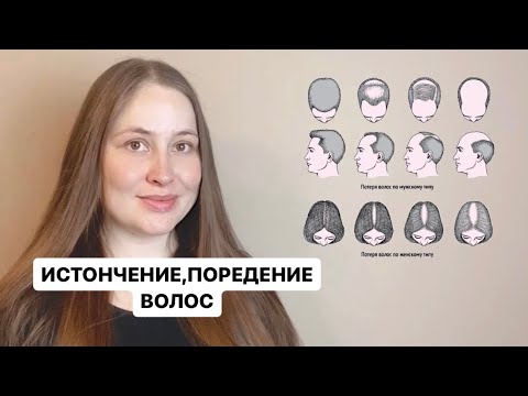 Видео: Андрогенная алопеция: 5 фактов про самую популярную причину истончения волос