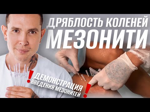 Видео: ДРЯБЛОСТЬ КОЛЕНЕЙ как предотвратить #мезонити