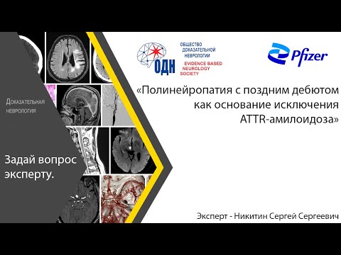 Видео: «Полинейропатия с поздним дебютом как основание исключения ATTR-амилоидоза»