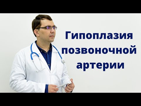 Видео: Гипоплазия позвоночной артерии