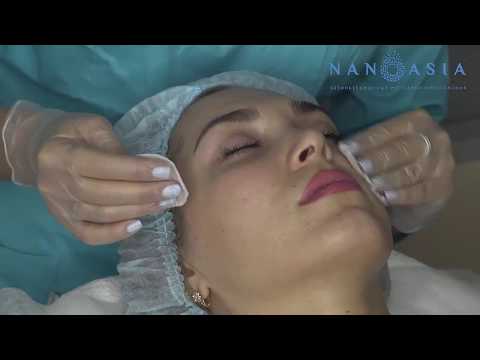 Видео: Процедура Наноазия Инструкция Nanoasia мезотерапия без инъекций. Биорепарация