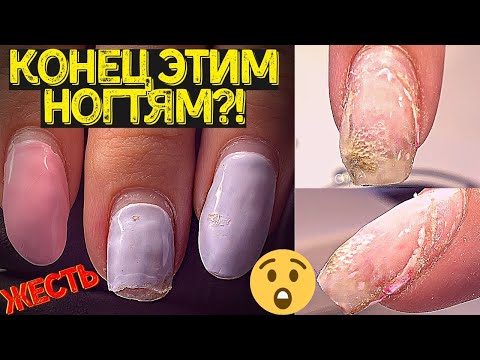 Видео: Жуткие отслойки 😱 Испортили ногти 😭 Переделаю ли маникюр?
