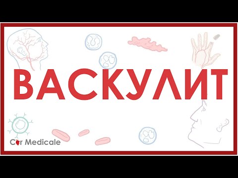 Видео: Васкулит