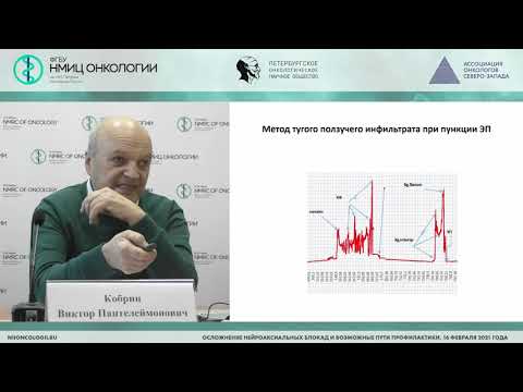 Видео: Технические особенности выполнения эпидуральной блокады (Кобрин В.П.)