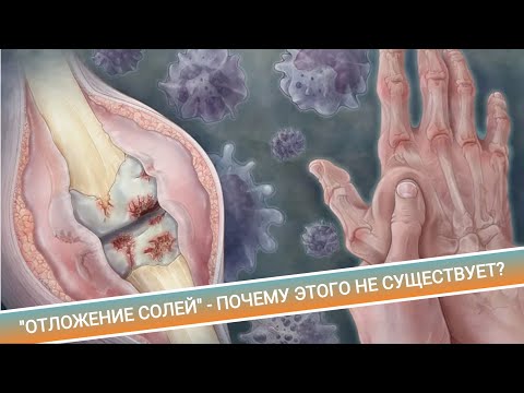 Видео: "ОТЛОЖЕНИЕ СОЛЕЙ" - ПОЧЕМУ ЭТОГО НЕ СУЩЕСТВУЕТ?
