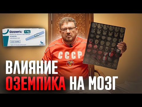 Видео: Мозг инсульт Оземпик