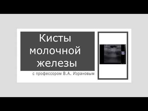 Видео: Кисты молочной железы