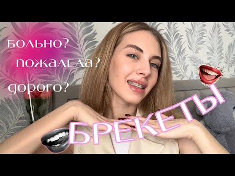Видео: это нужно ПОСМОТРЕТЬ перед тем, как ставить БРЕКЕТЫ | мой опыт