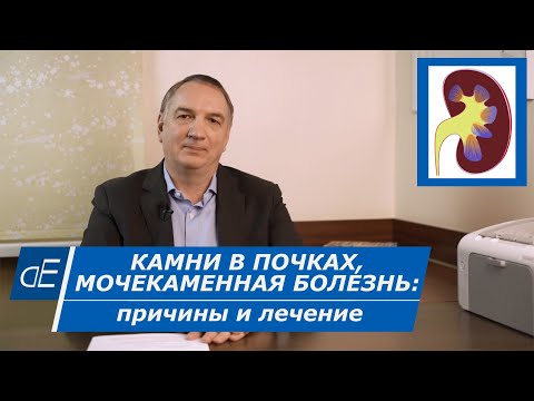 Видео: КАМНИ в ПОЧКАХ:  ЛЕЧЕНИЕ в домашних условиях. /  Мочекаменная болезнь, ПЕСОК в почках: что делать?