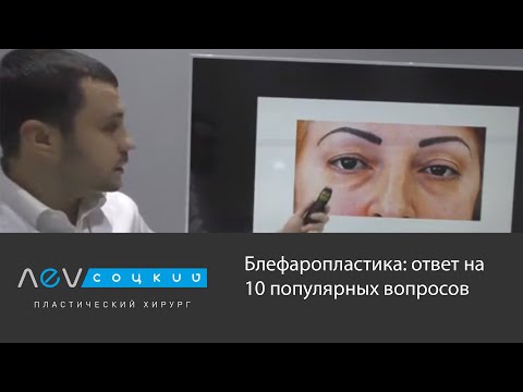 Видео: Блефаропластика: ответ на 10 популярных вопросов