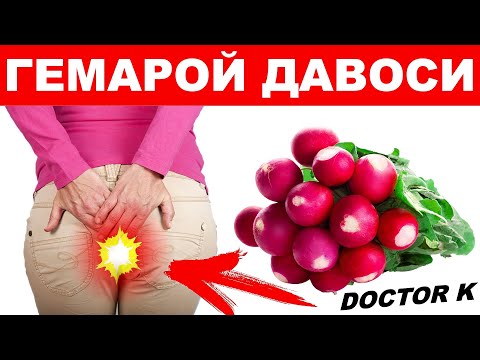 Видео: ОДДИЙ РЕДИСКА БИЛАН ГЕМАРОЙНИ ДАВОЛАДИМ! БУ МЎЖИЗА. ШОКДАМАН...