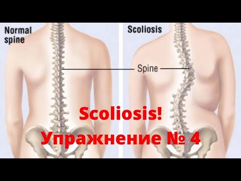 Видео: Гръбначно изкривяване Сколиоза “Scoliosis” упражнение № 4