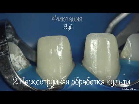 Видео: Цикл Препарирование. Видеоурок 4