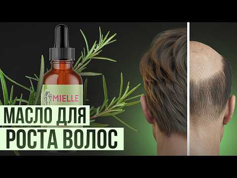 Видео: РОЗМАРИНОВОЕ МАСЛО ПРИ АГА