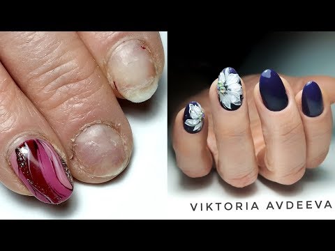 Видео: До Работа Другого Мастера Маникюра/ Коррекция и Наращивание/ Экспресс Маникюр/ Виктория Авдеева