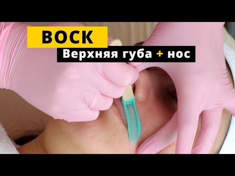 Видео: Депиляция полимерным воском. Верхняя губа и нос.