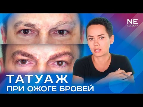 Видео: #Татуаж и ожог бровей