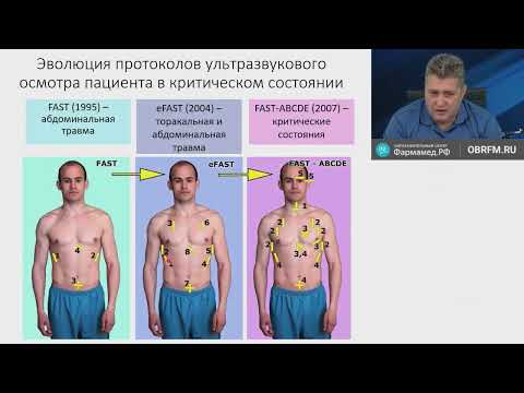 Видео: Ультразвуковая оценка пациента с травмой Лахин Р.Е. 23