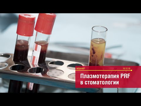 Видео: Плазмотерапия PRF в стоматологии