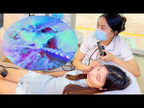 Видео: Пригласите друзей визуально выбрать и помыть уши｜Качество 4K｜Передать в Maomao｜Ear SPA