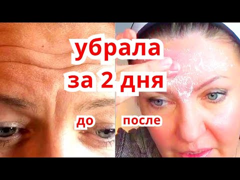Видео: Супер Маска от Морщин на Лбу и Межбровной Морщины Убрала Всего за 3 Дня