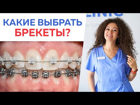 Видео: Какие брекеты выбрать? / Что лучше – металлические брекеты или керамические брекеты?